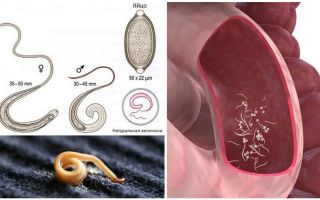 วิธีการกำจัด pinworms ในผู้ใหญ่และเด็ก