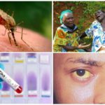 Zika, West Nile และไวรัสไข้เหลือง