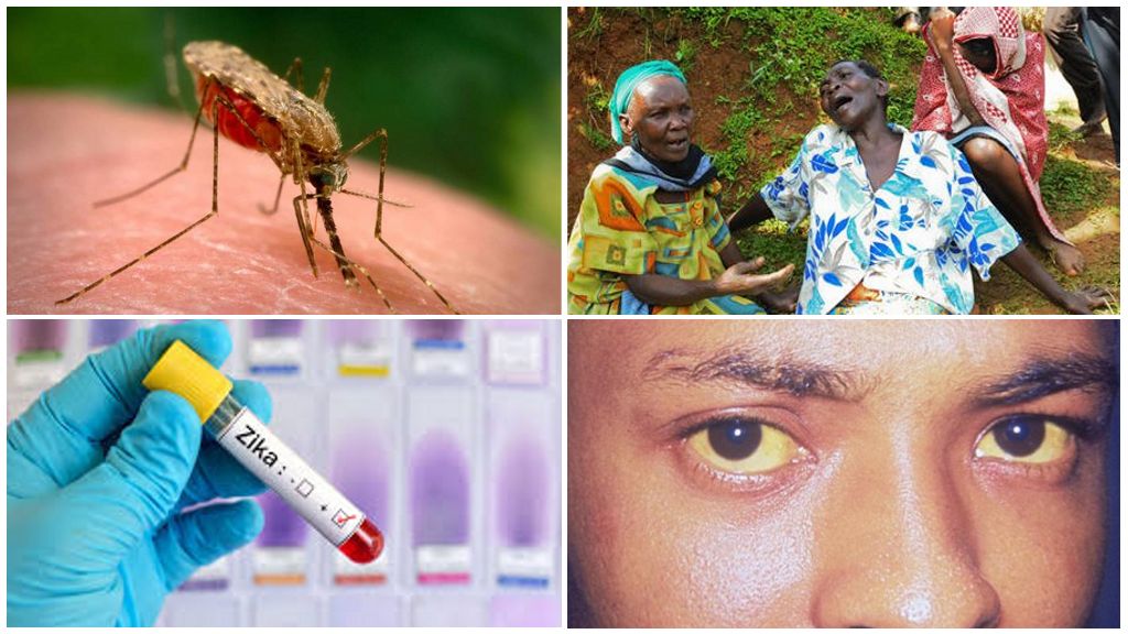 Zika, West Nile และไวรัสไข้เหลือง